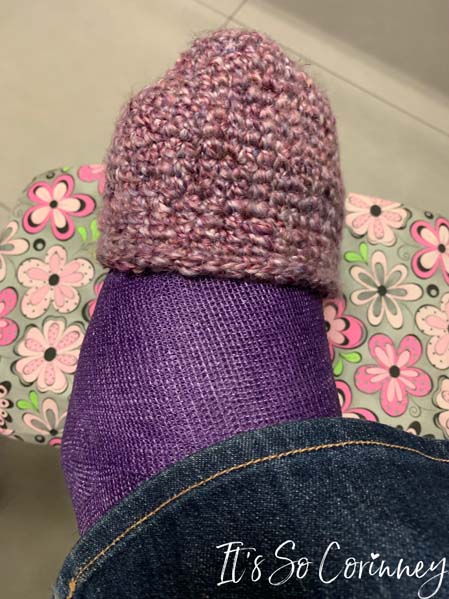 Finished Cast Toe Cover